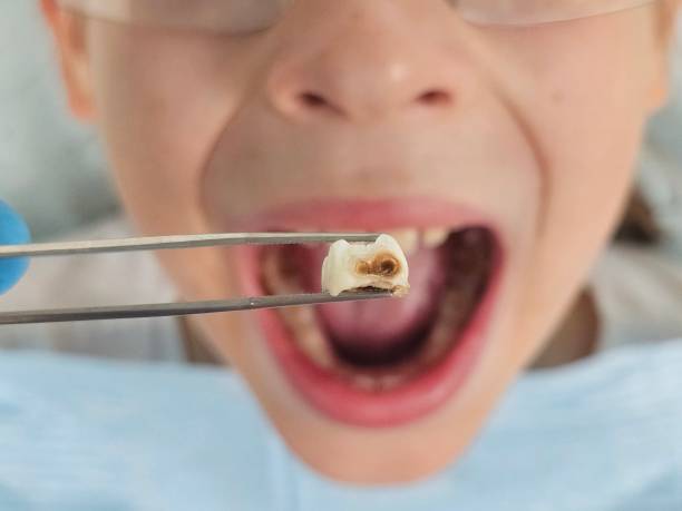 Best Emergency Denture Repair in Woodburn, VA